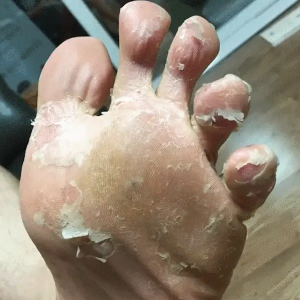 imgi_35_Good-byeDirtyFootSolution