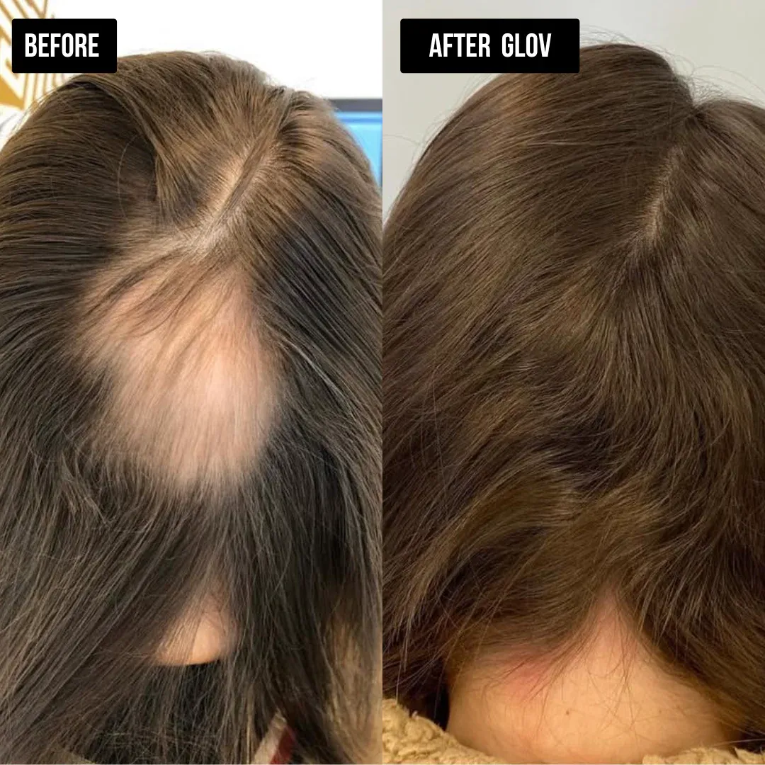 imgi_10_hairjanuary_12