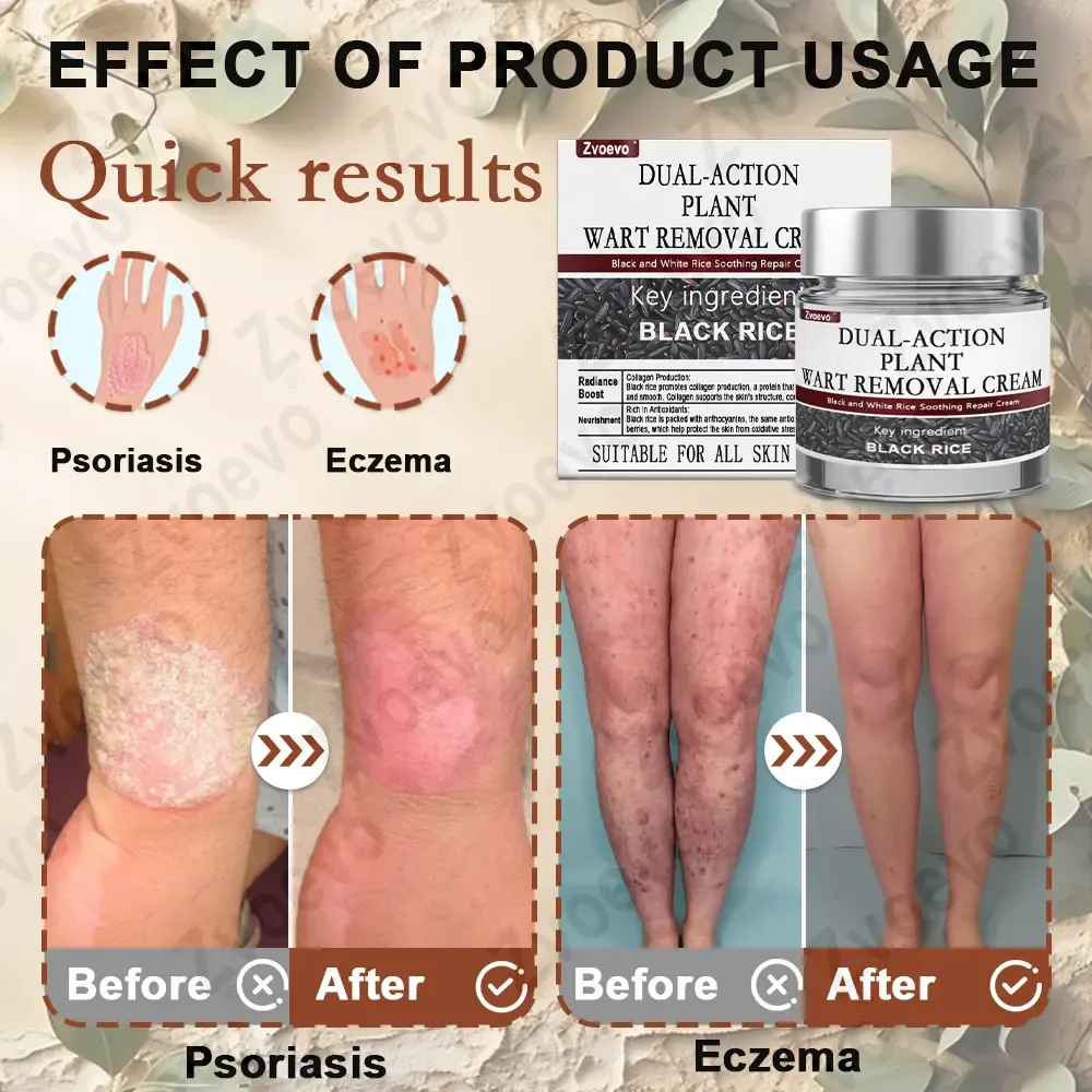 imgi_112_Zvoevo-Black-Rice-Skin-Repair-Essence-Cream-868-12