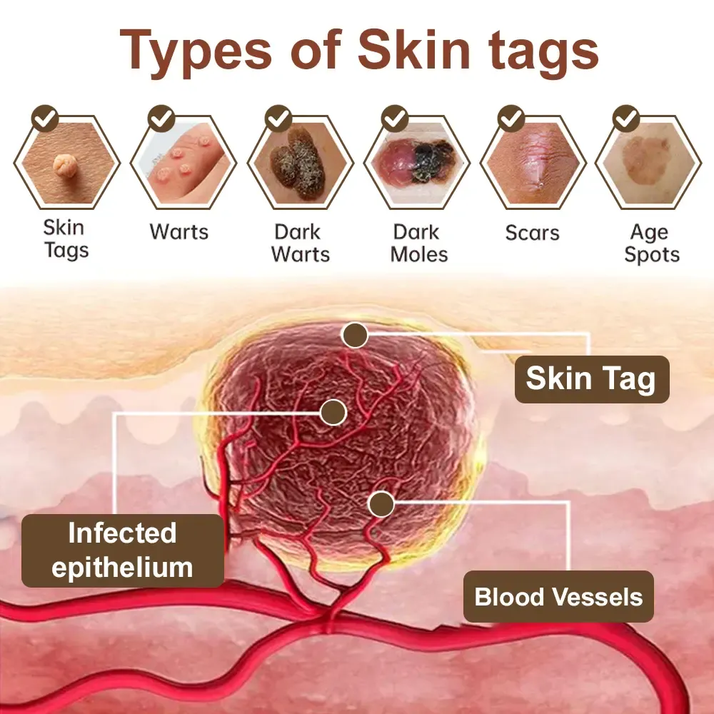 imgi_99_Zvoevo-Black-Rice-Skin-Repair-Essence-Cream-868-9